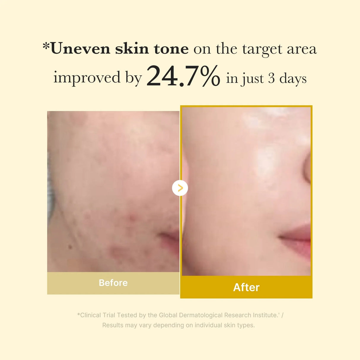 Medicube Kojic Acid Turmeric Mask