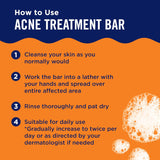 PanOxyl Acne Treatment Bar with 10% Benzoyl Peroxide Bar Soap